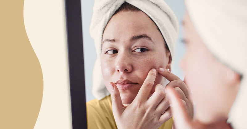 What The Best Skin Care Product for Acne