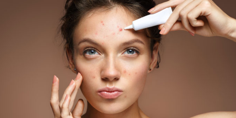What Are The Best Skin Care Products For Acne