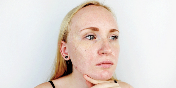 What Are The Best Skin Care Products Recommended By Dermatologists