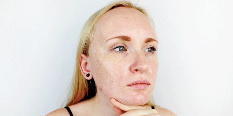 What Are The Best Skin Care Products Recommended By Dermatologists