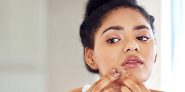 Best Skin Care Products for Acne