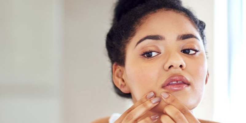Best Skin Care Products for Acne