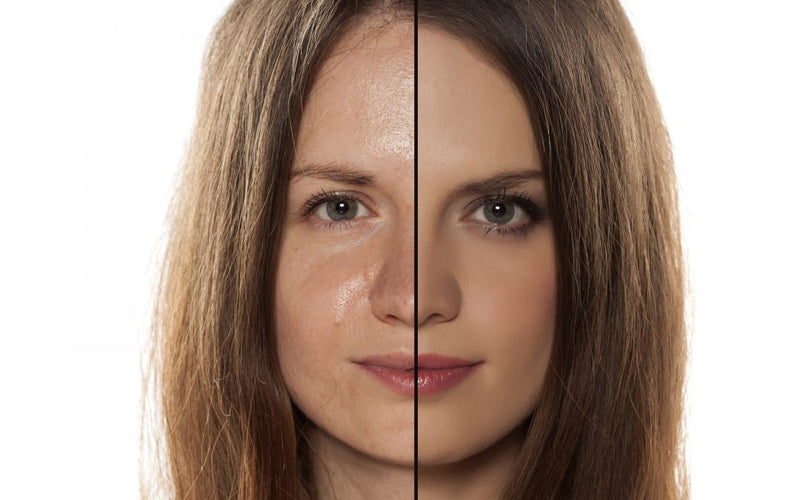 Anti Aging Products Make Forehead Shiny But Not Oily