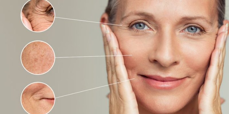 What Are The Symptoms Of Aging Skin?