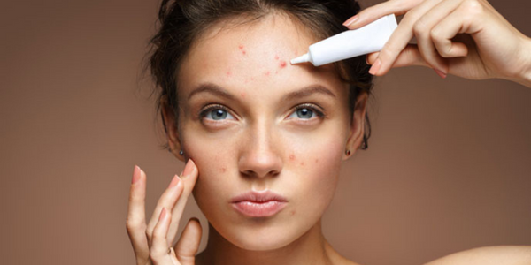 Acne Skin Care