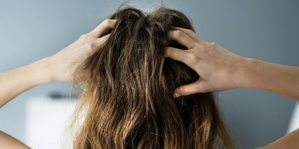 Hair Care Products For Dry Scalp