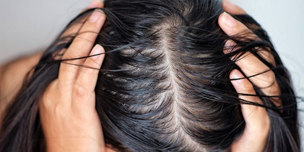 Best Hair Care Products For Oily Scalp And Dry Ends