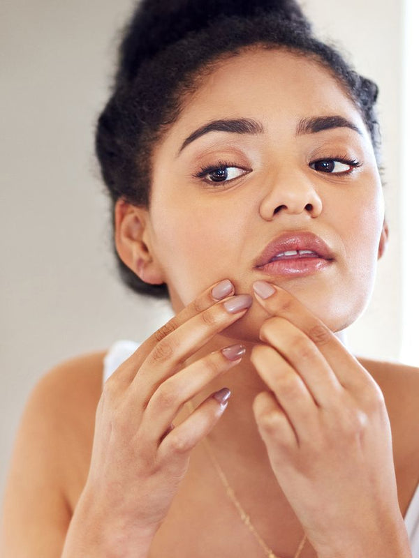 Which Skin Care Product is Best for Acne